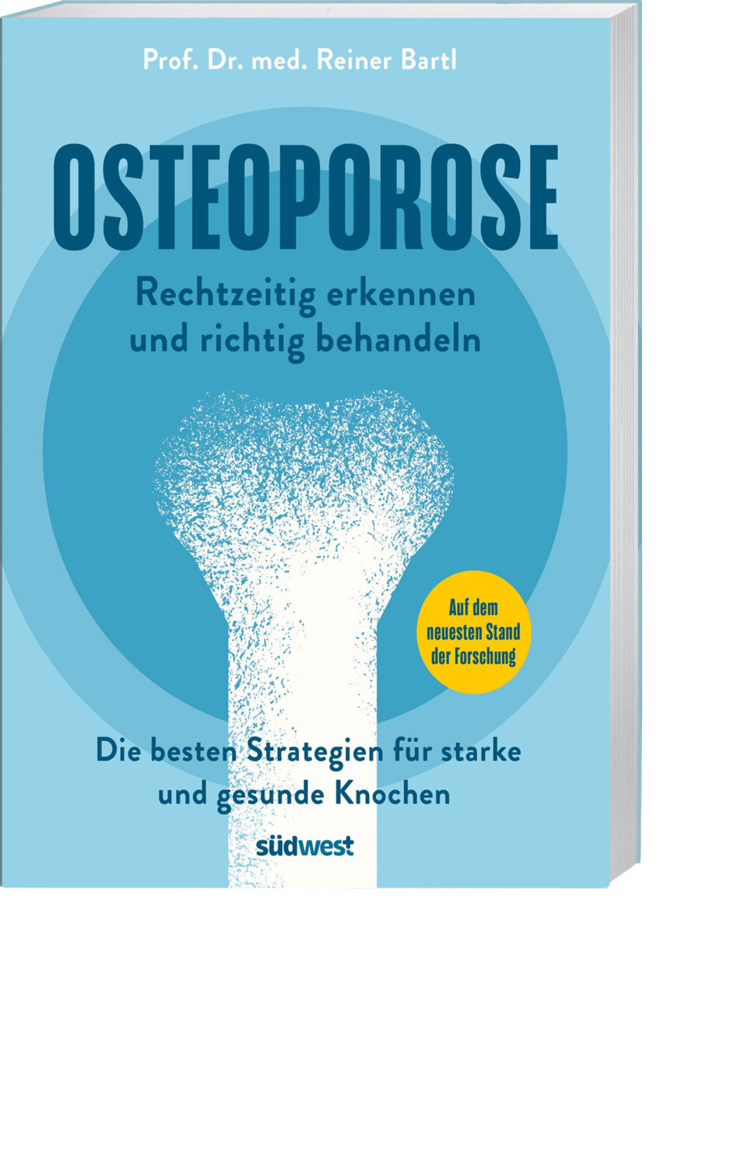 Osteoporose rechtzeitig erkennen und behandeln, Produktbild 1